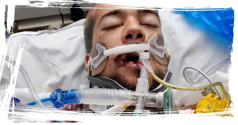 ‘He shouldn’t be alive,’ Colorado Springs 21-year-old miraculously survives critical motorcycle crash